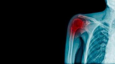 Sliding into place: Study shows how cartilage interacts with the joints in our bodies